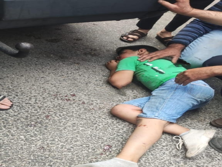 إصابة طفل نتيجة تعرضه لحادث صدم في بلدة مرياطة